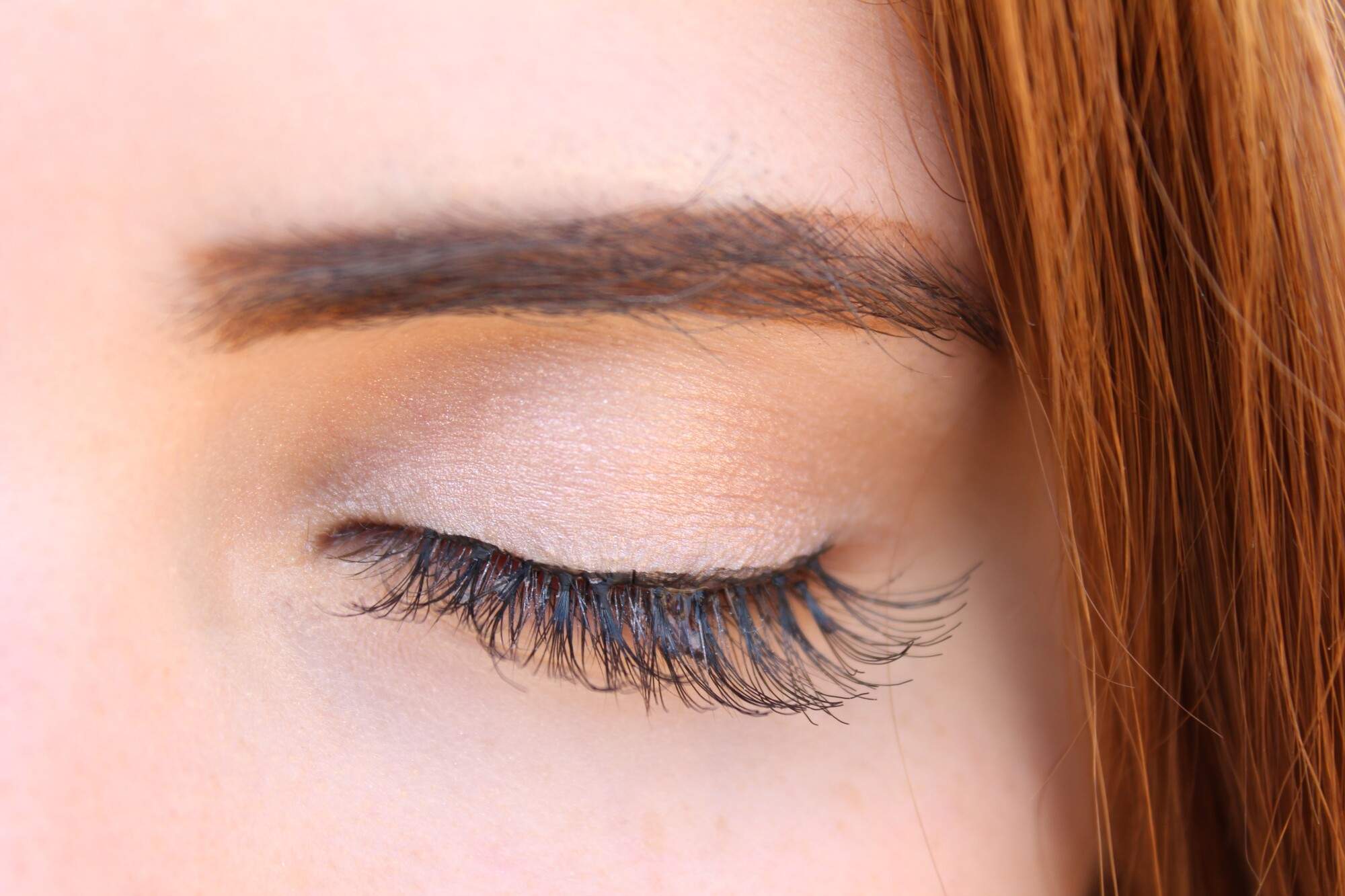 How To Get Rid Of Eyelash Mites Trendzzzone 