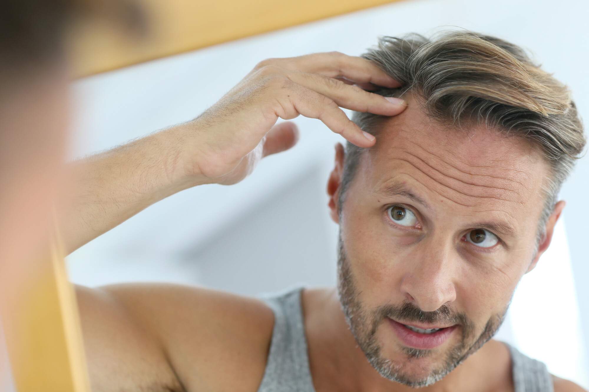 3 Pro Tips to Prevent Balding